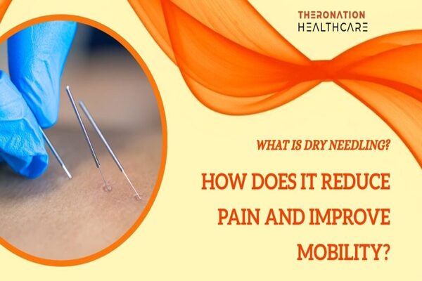 dry neddling